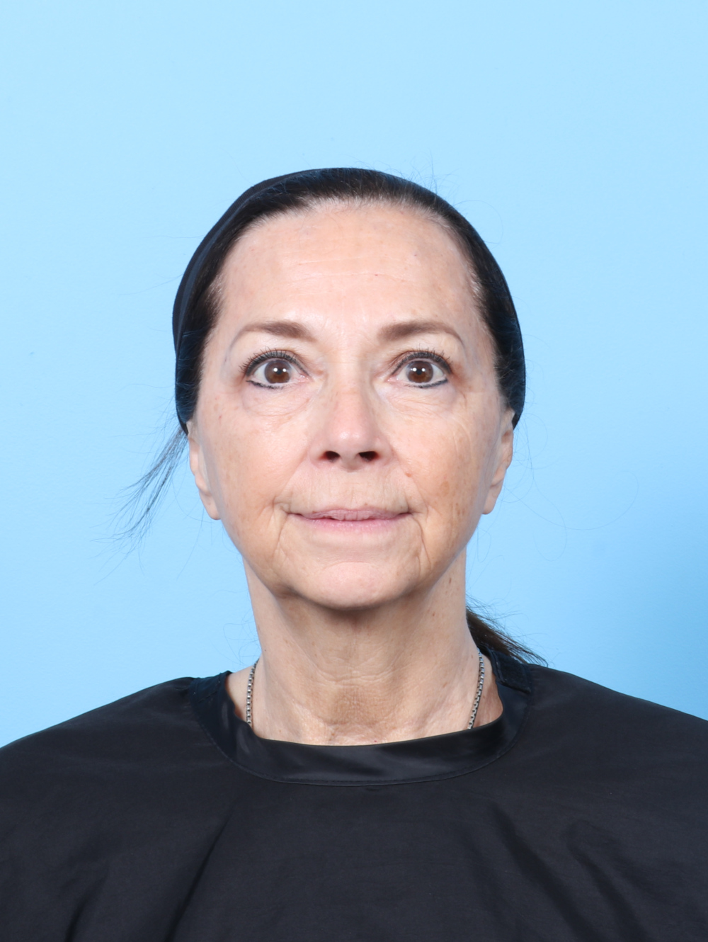 MG-UBLEPH-64YRS-FRONT-AFTER-EDITED