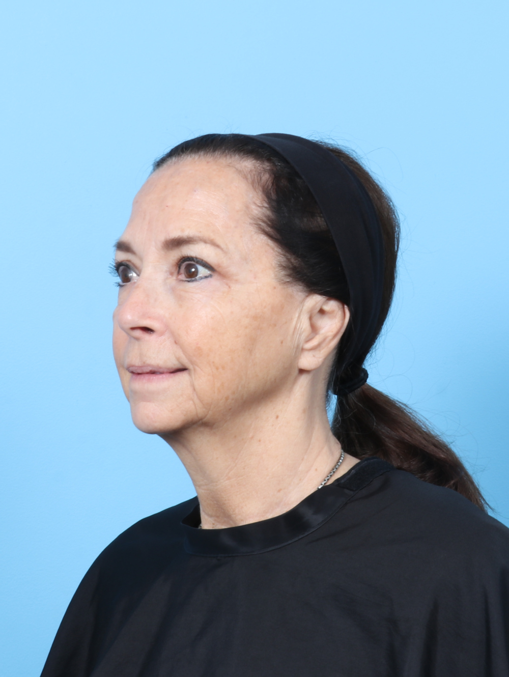 MG-UBLEPH-64YRS-OBL-AFTER-EDITED